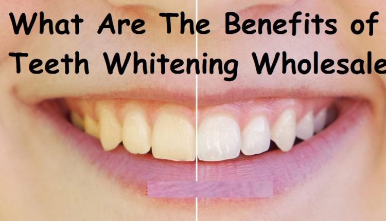 What Are The Benefits of Teeth Whitening