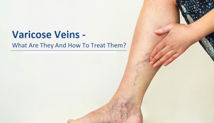 What Are They And How To Treat Them