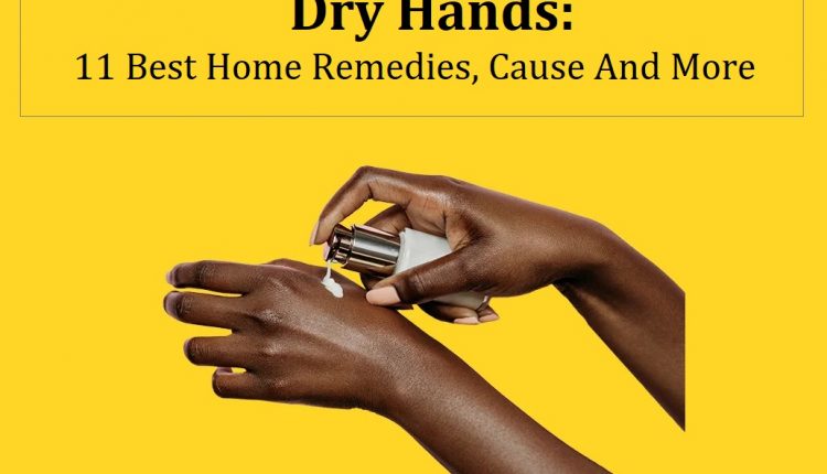 Dry Hands